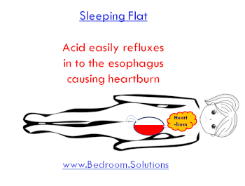prevention of GERD on Glideaway adjustable bed How elevation lift prevents acid reflux in sleepers with heartburn
